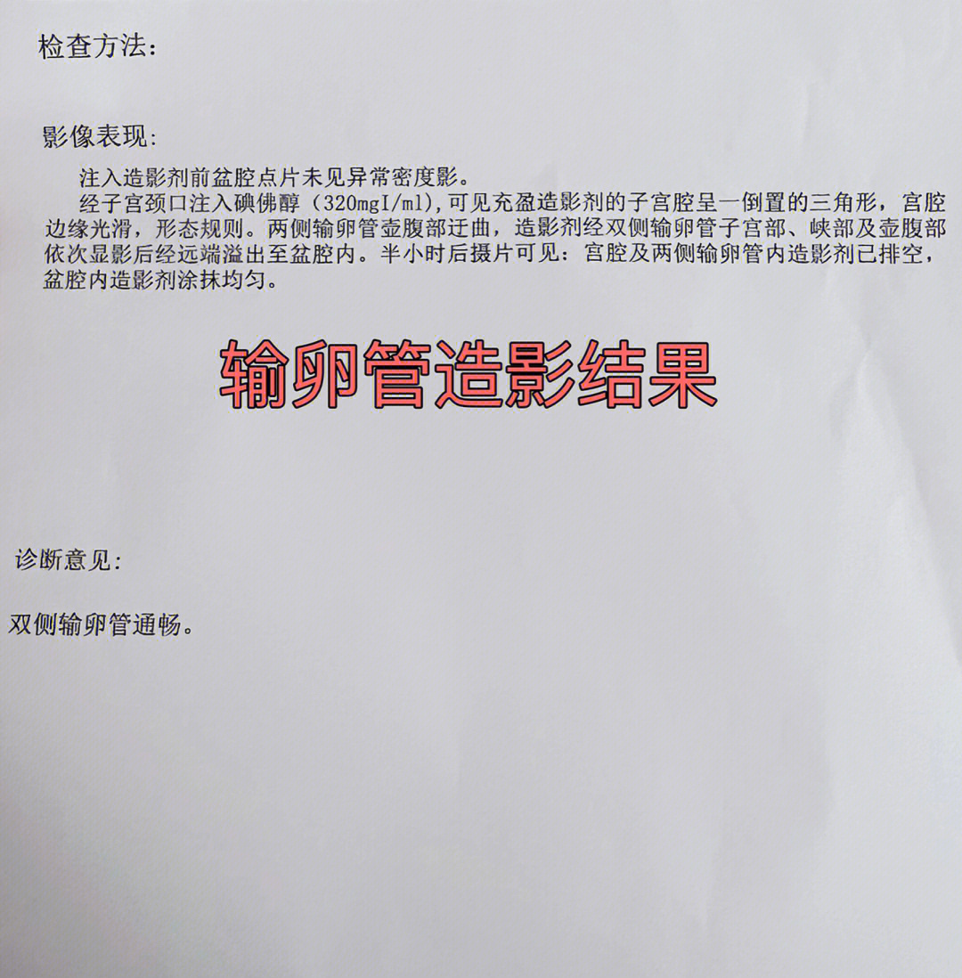 输卵管造影体验 碘佛醇检查全记录